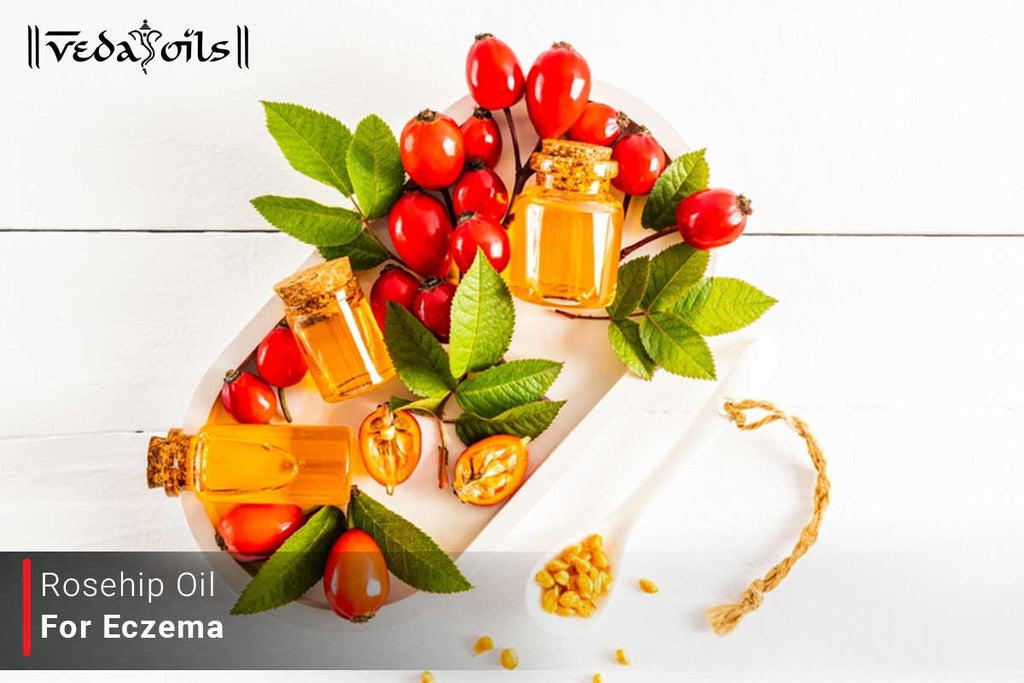 Rosehip Oil For Eczema Benefits & How To Use VedaOils