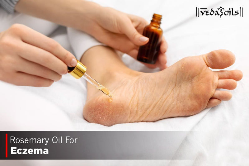 Rosemary Oil For Eczema - Benefits & How To Use