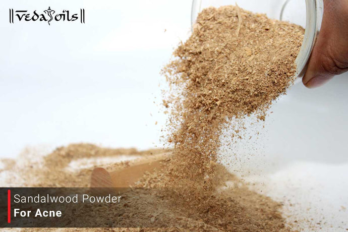 Sandalwood Powder for Acne - Prevents Pimples Naturally