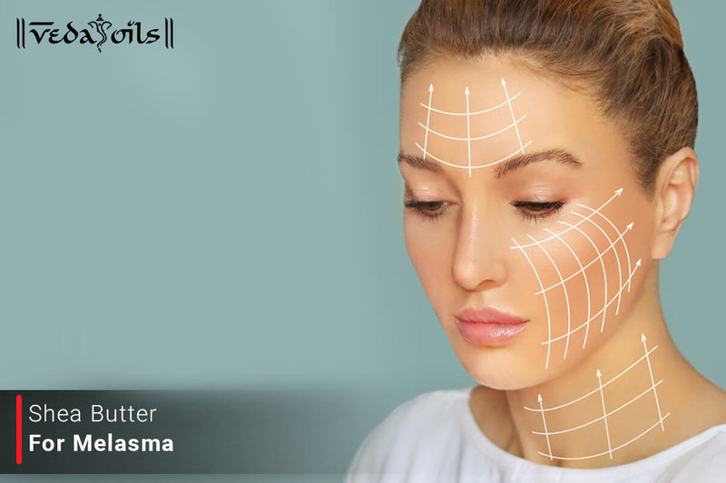 Shea Butter For Melasma - DIY Recipe & Benefits