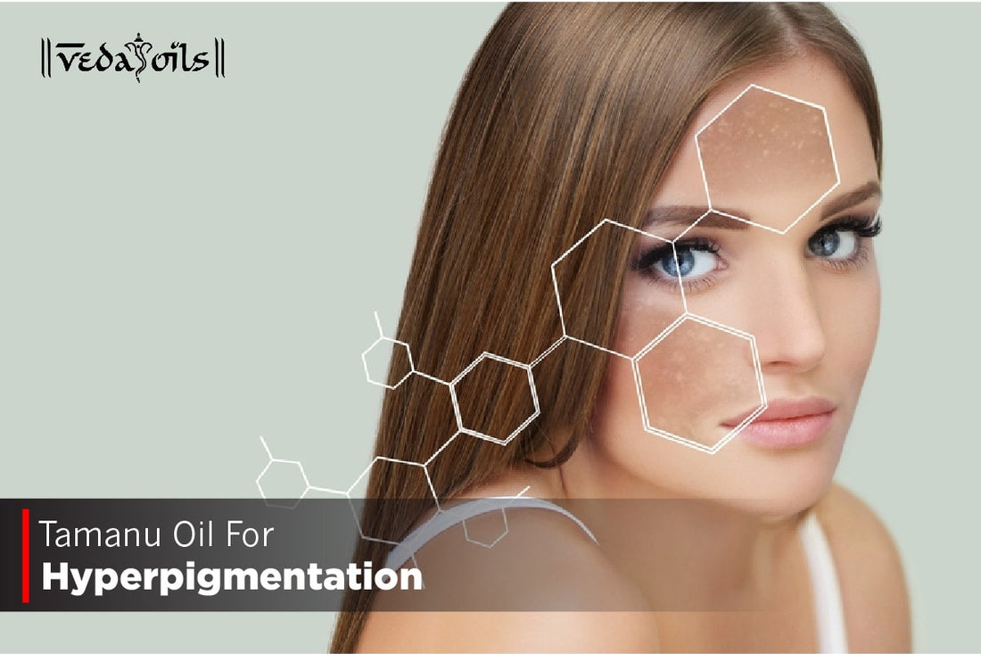 Tamanu Oil For Hyperpigmentation