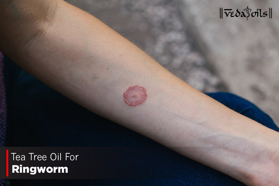 Tea Tree Oil For Ringworm