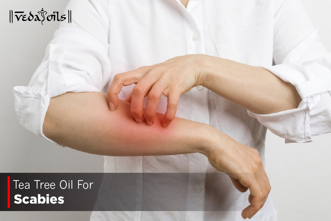 Tea Tree Oil For Scabies
