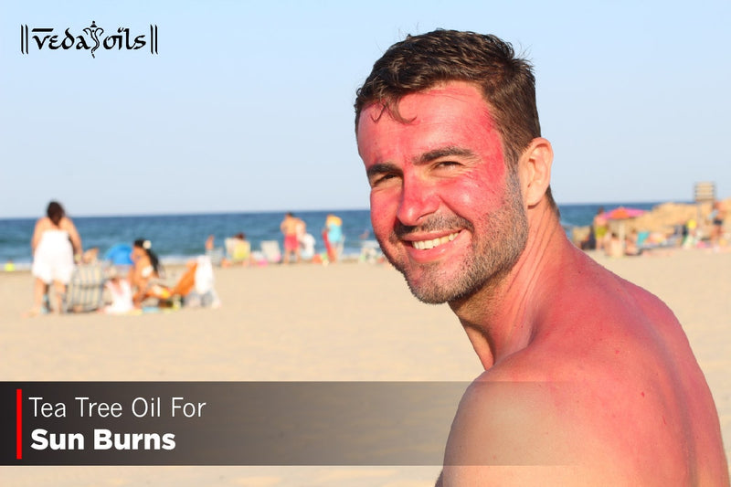 Tea Tree Oil For Sunburn - Does it Work?