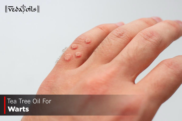 Tea Tree Oil For Warts - Benefits & Uses