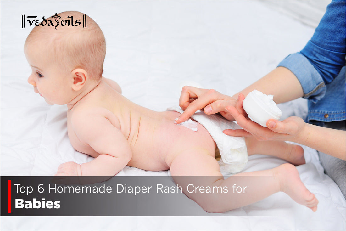 Top 6 Homemade Diaper Rash Creams for Babies