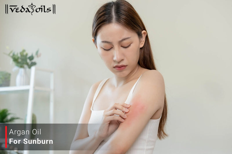 Argan Oil For Sunburn - Benefits & How To Use