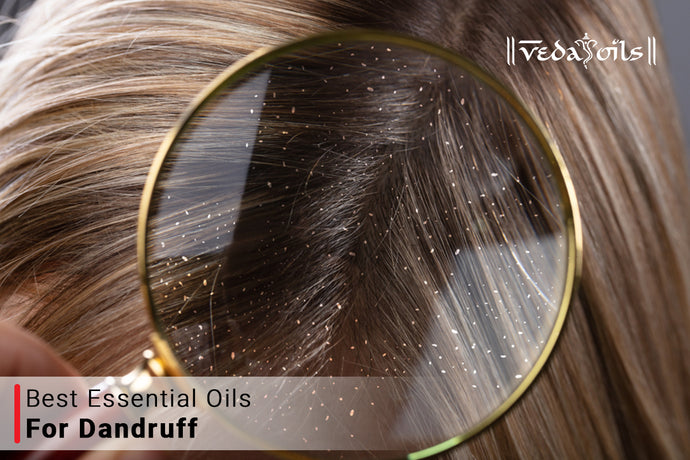 Essential Oils For Dandruff - Control Hairfall & Dry Scalp