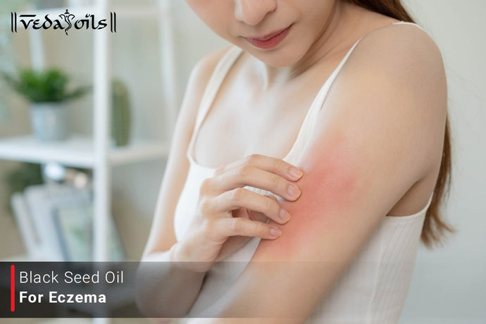 Black Seed Oil For Eczema | Eczema Treatment With Black Seed Oil