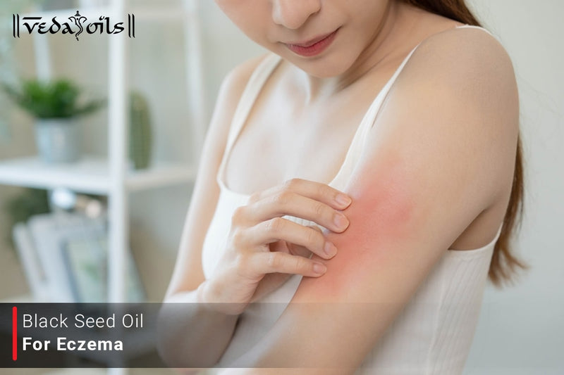 Black Seed Oil For Eczema - Benefits & How To Use