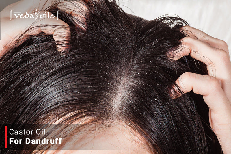 Castor Oil For Dandruff - Treat Pesky Dandruff Naturally