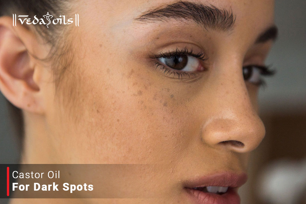 Castor Oil For Dark Spots DIY Recipes To Remove Dark Spots VedaOils