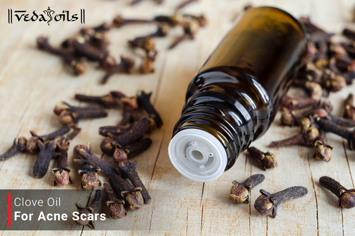 Natural Clove Oil For Acne Scars Treatment