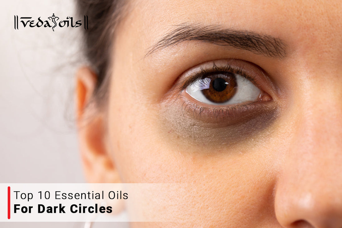 essential oils for dark circles