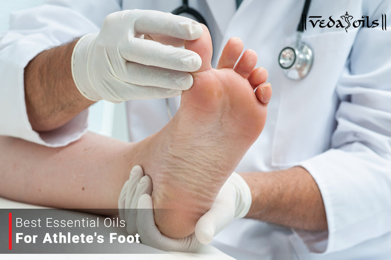 8 Best essential oil for athlete's foot Treatment at Home