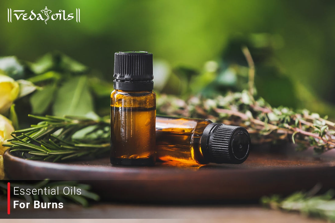 essential oils for burns