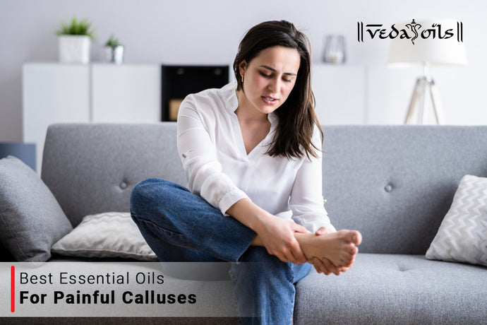 Essential Oils For Calluses - Callus Removal on Feet & Toes