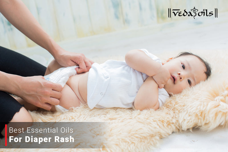 Essential Oils For Diaper Rash - Yeast Diaper Rash