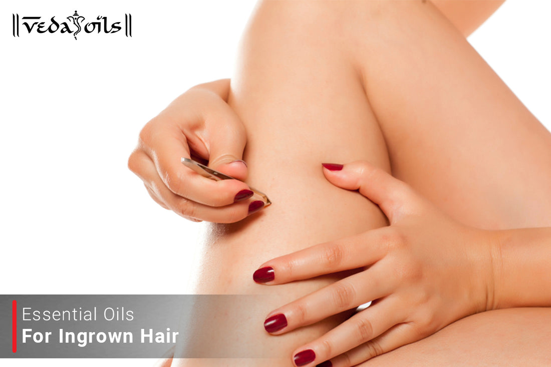 essential oils for ingrown hair