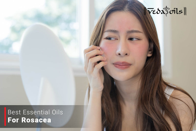 Essential Oils for Rosacea: Natural Relief That Actually Calms Redness