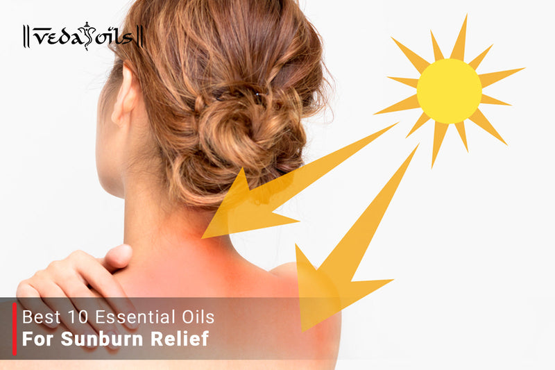 Essential Oils For Sunburn Relief