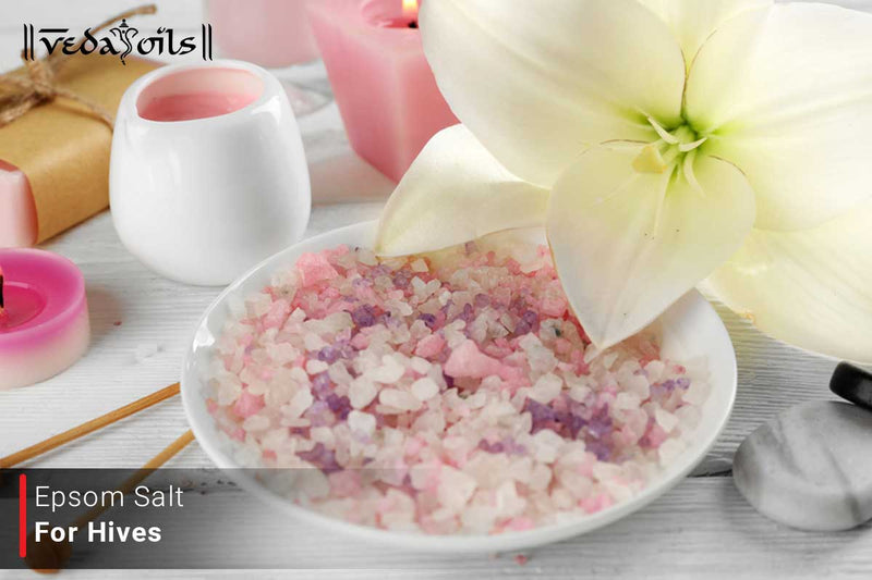 Epsom Salt for Hives - How It Helps and How to Apply