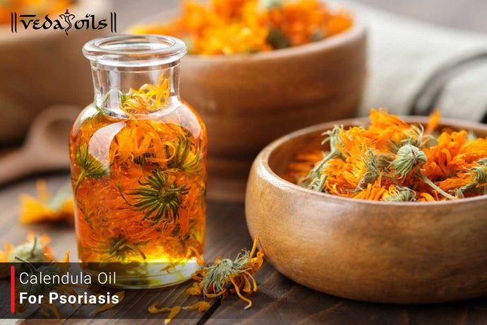 Calendula Oil For Psoriasis - How To Use It?