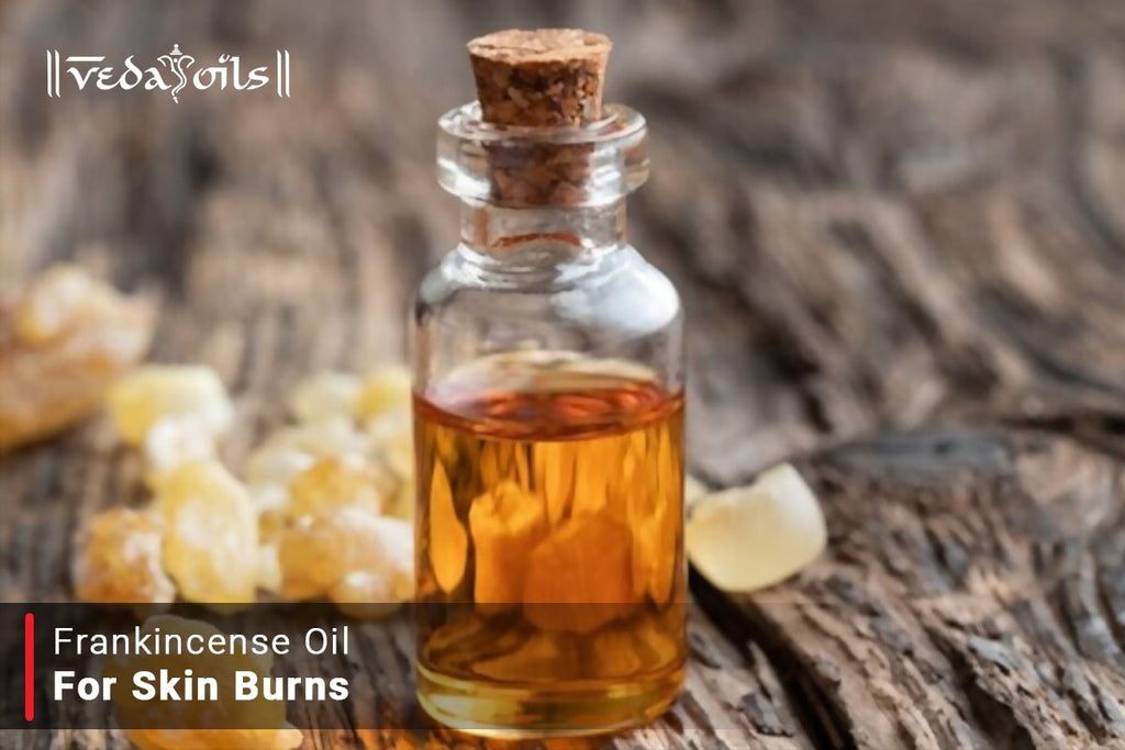 Frankincense Oil For Burns Relief VedaOils