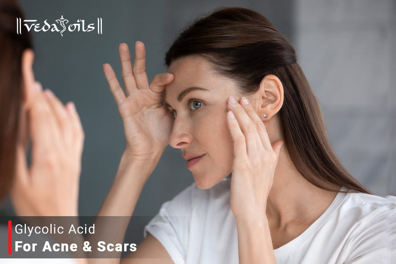 Glycolic Acid For Acne Scars - Is It Effective?