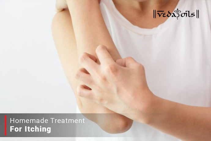 Homemade Treatment For Itching - Cure Itch Naturally
