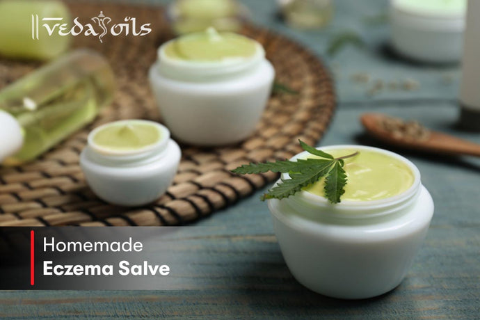 How To Make Eczema Skin Salve at Home