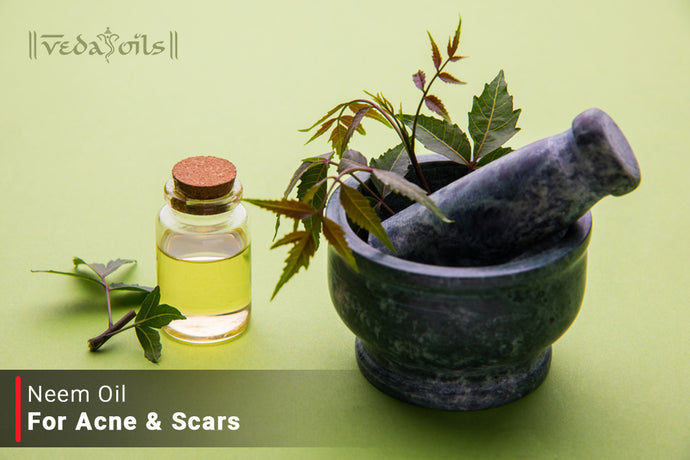 Neem Oil For Acne Scars - Benefits & DIY Recipes