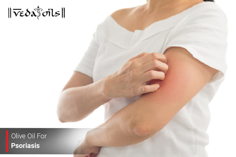 Olive Oil for Psoriasis – Natural Skin & Scalp Care at Home