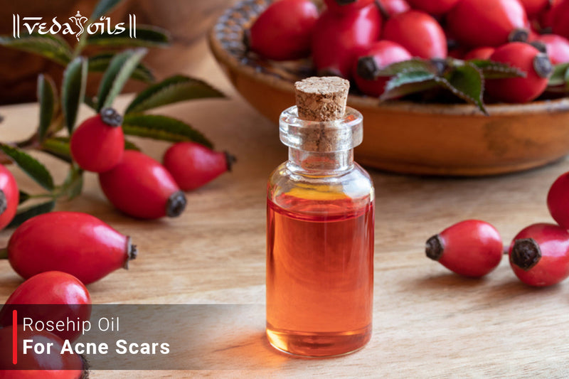 Rosehip Oil for Acne Scars – Benefits, Uses & DIY Recipes for Clear Skin