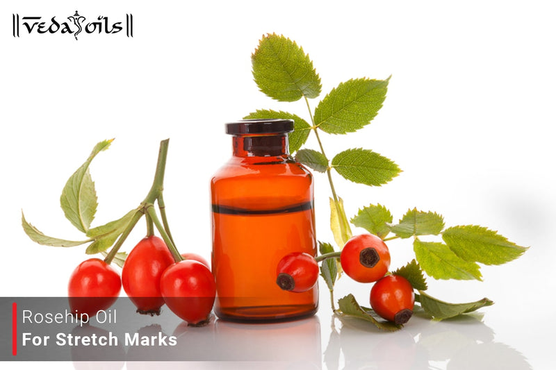 Rosehip Oil For Stretch Marks - Benefits & Recipe