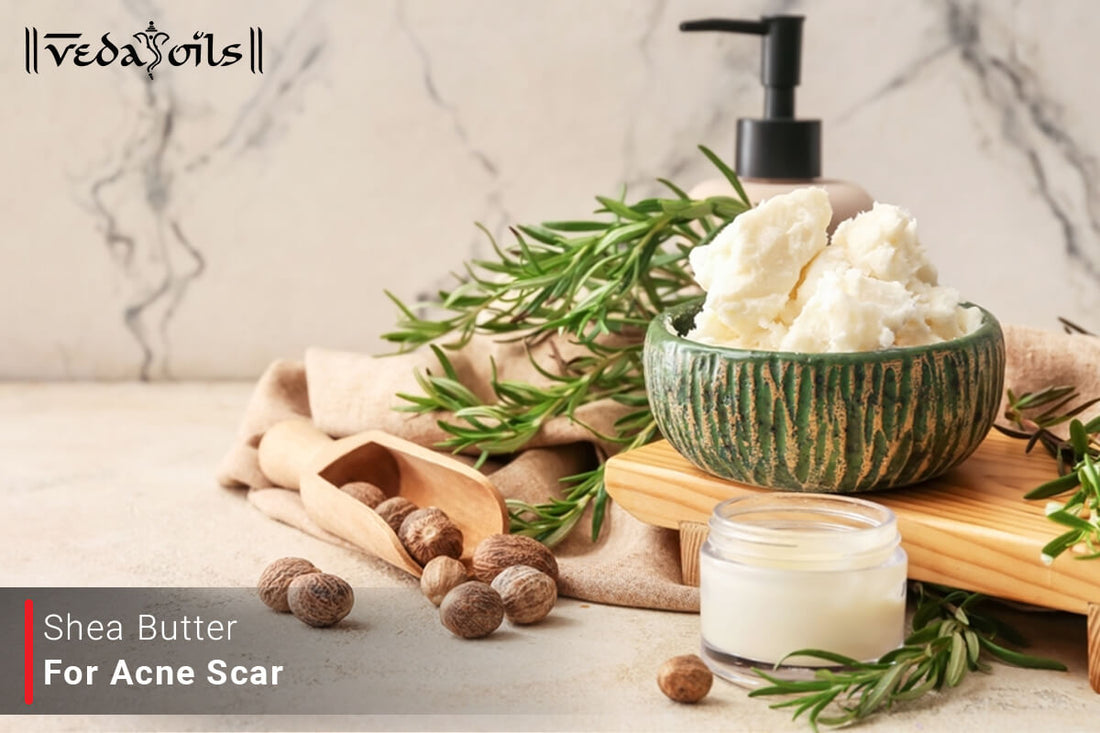 Shea Butter For Acne - Is Shea Butter Bad for Acne Prone Skin?