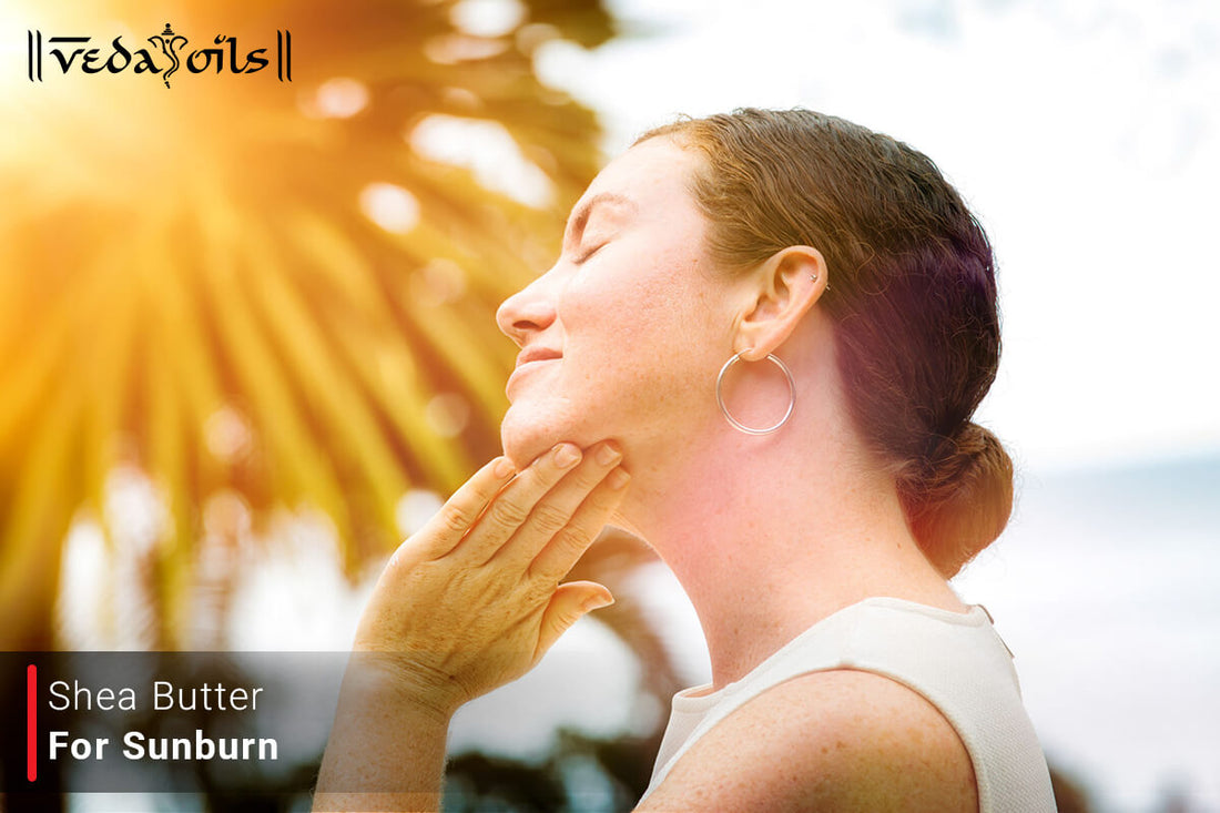 Shea Butter For Sunburn - Is Raw Shea Butter Good For Sunburn?