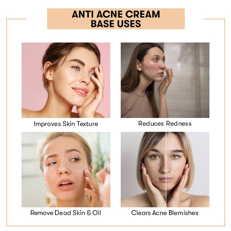 Anti Acne Cream Base Uses