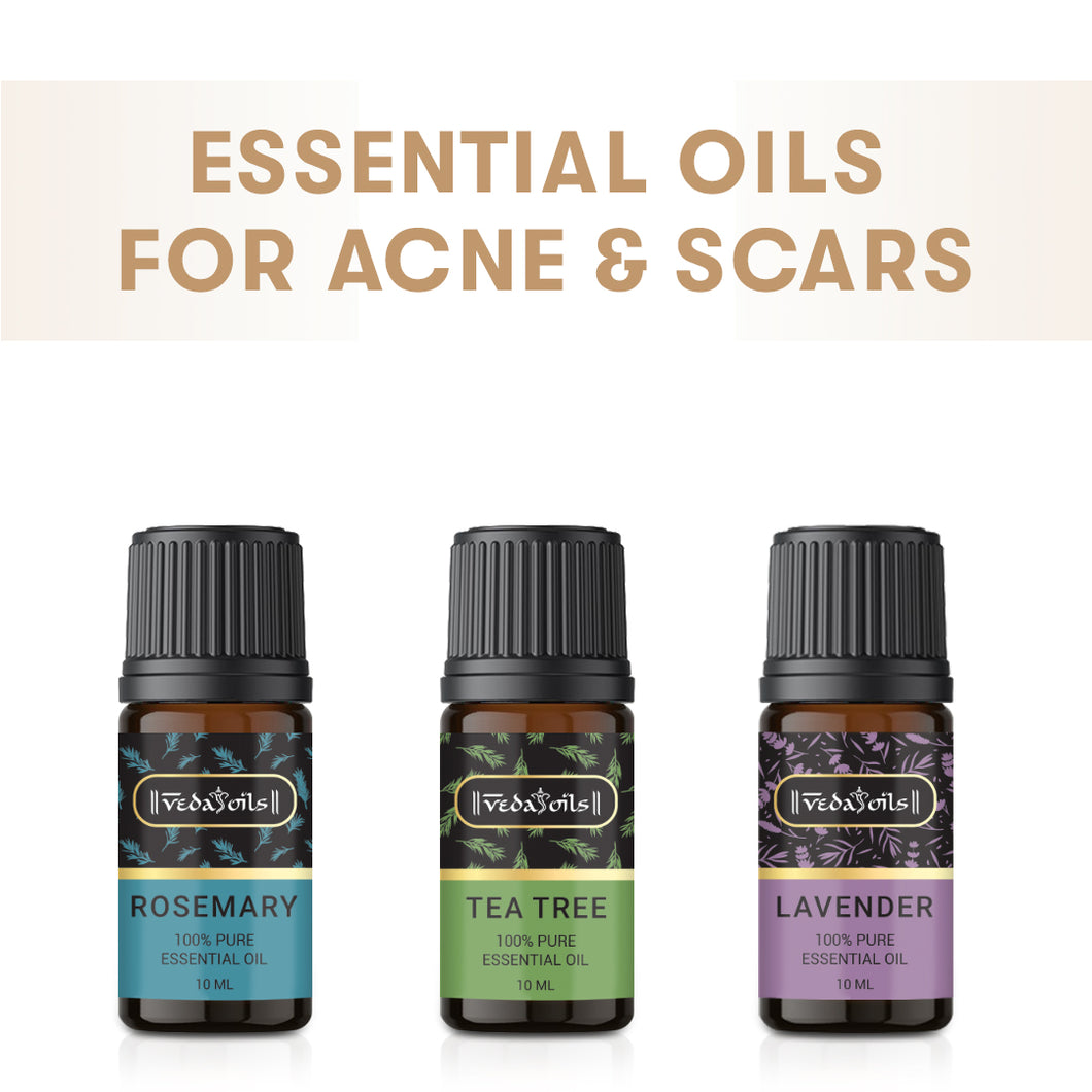 Essential Oils for Acne Bundle - 10 ML Each