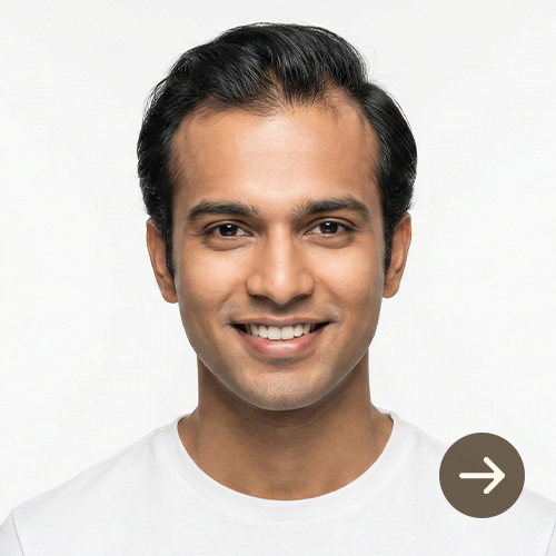 Hair Loss & Thinning