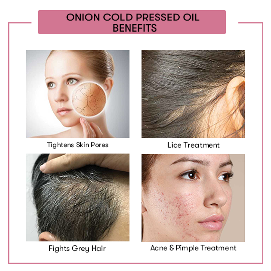 Onion Cold Pressed Oil