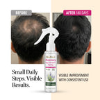 Rosemary Hair Growth Spray