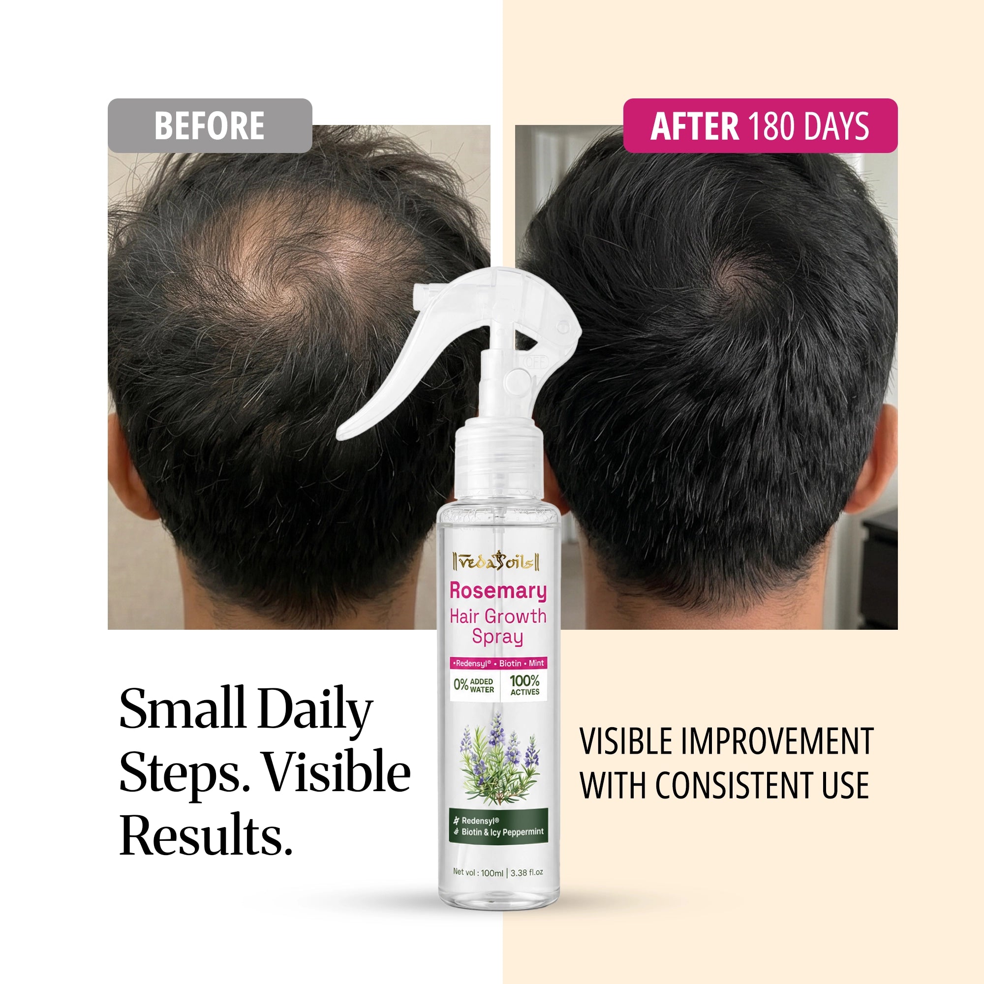 Rosemary Hair Growth Spray