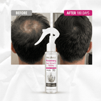 Rosemary Hair Growth Spray